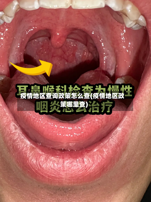 疫情地区查询政策怎么查(疫情地区政策哪里查)