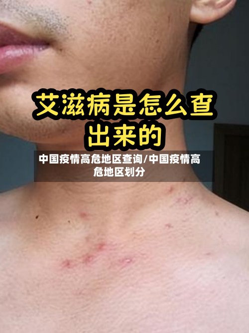 中国疫情高危地区查询/中国疫情高危地区划分-第2张图片