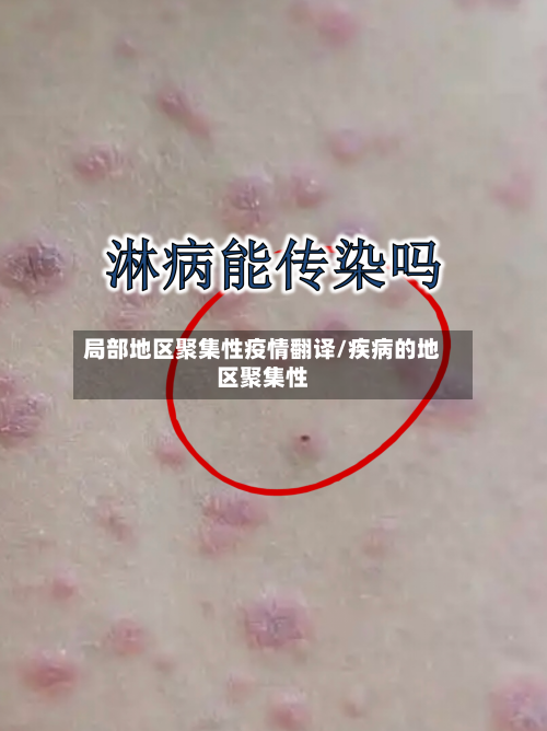 局部地区聚集性疫情翻译/疾病的地区聚集性-第3张图片